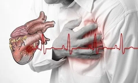 Liên tiếp cấp cứu nhiều ca vỡ tim: Bác sĩ đưa ra khuyến cáo
