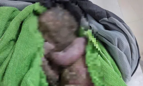 Cứu sống trẻ sơ sinh bị bỏ rơi đã ngừng tim, người đầy bùn đất