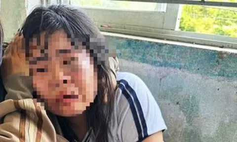 Nữ sinh lớp 7 bị 2 nam sinh lớp 9 đánh nhập viện