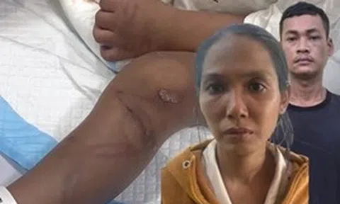 Vụ bé trai 2 tuổi bị mẹ ruột và người tình bạo hành dã man: Nhân chứng chưa hết ám ảnh, tiết lộ tình tiết đau lòng