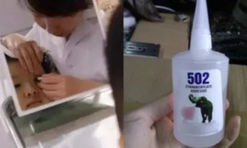 Cậu bé 3 tuổi bắt chước bà nhưng nhỏ nhầm keo 502 vào mắt: Mẹ sơ cứu trong 15 phút, bác sĩ nói "không cần điều trị nữa"