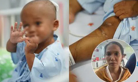 Hình ảnh xúc động của bé trai 2 tuổi bị bạo hành: Đã biết cười, chơi đùa trở lại nhưng phải theo dõi dập phổi