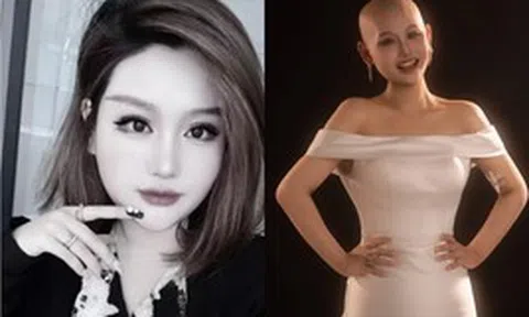 Cô gái từng tổ chức đám cưới với chính mình qua đời ở tuổi 29: Chia sẻ cuối cùng gây xúc động mạnh