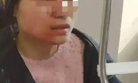 Cô giáo tiểu học bị đâm vỡ nhãn cầu vì can ngăn học sinh đánh nhau: Kẻ thủ ác không bị xử phạt vì chưa đủ 14 tuổi!