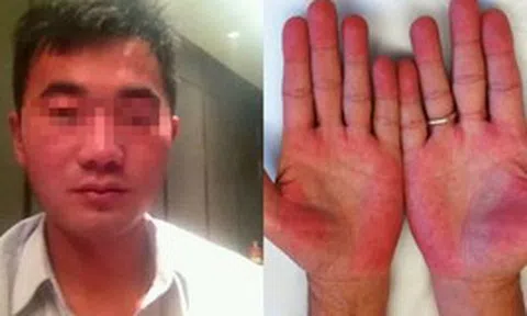Người đàn ông không bia rượu nhưng ngày nào cũng bị kiểm tra nồng độ cồn, biết sự thật phía sau ai cũng xót xa
