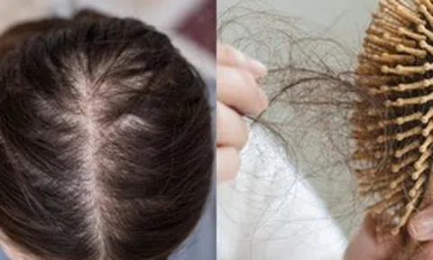 Đừng chỉ ăn trứng luộc để ngừa tóc rụng! "Nữ thần không tuổi" Thái Y Lâm luôn làm việc này trước 21h30 cho da đẹp tóc khỏe, bác sĩ cũng phải khen