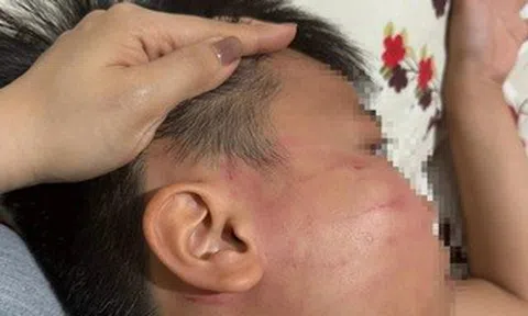 Thầy giáo Ấn Độ bị tố tát học sinh lớp 4 trong lớp học thêm ở Gia Lai