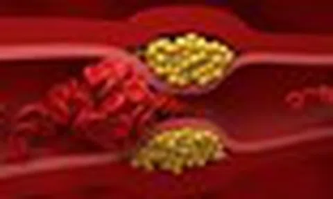 Không cần thực phẩm đắt tiền, bác sĩ chỉ 4 món quen thuộc giúp giảm cholesterol “cực đỉnh”