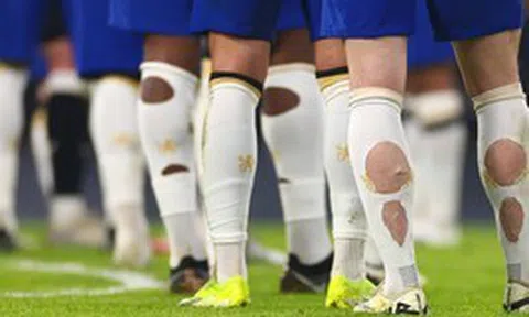 Phát hiện nhiều cầu thủ World Cup đi tất rách ra sân