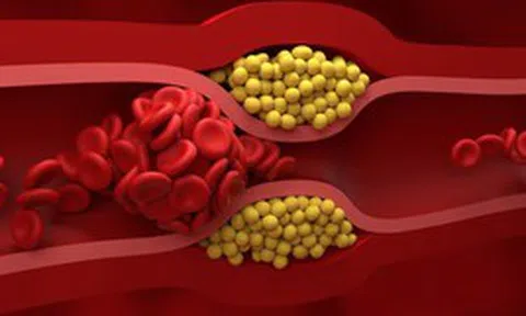 Không cần thực phẩm đắt tiền, bác sĩ chỉ 4 món quen thuộc giúp giảm cholesterol “cực đỉnh”