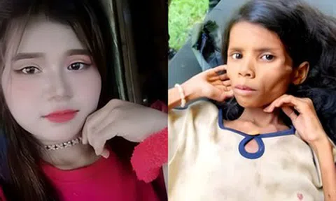 Bé gái mất tích 47 ngày trong rừng, gầy trơ xương khi được tìm thấy, giờ ra sao?