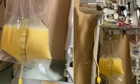 Người phụ nữ 32 tuổi "máu trắng đục như sữa" vì thứ quen thuộc trong tủ thuốc