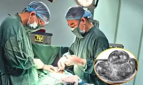 Bụng phình to bất thường, sự thật bác sĩ nói ra khiến người phụ nữ sốc nặng
