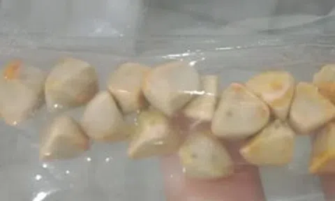 Uống trà đá đều đặn suốt 10 năm, người phụ nữ sốc khi bác sĩ lấy ra thứ "đáng sợ" trong bụng