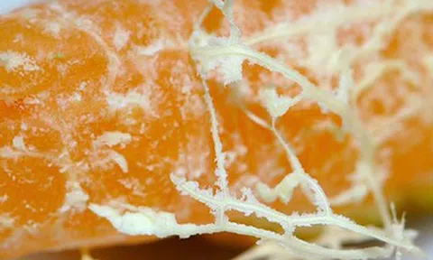 Tưởng chỉ có sữa, hóa ra 3 loại quả bình dân ngoài chợ rất tốt cho xương trẻ