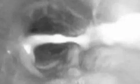 Bé trai 3 tuổi ho suốt 1 tháng, gia đình sửng sốt khi biết lý do