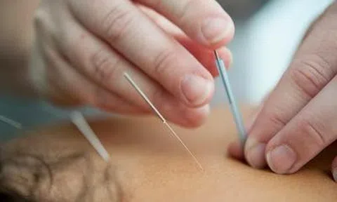 Đau chân dữ dội sau khi châm cứu, người phụ nữ sốc nặng khi biết sự thật đáng sợ