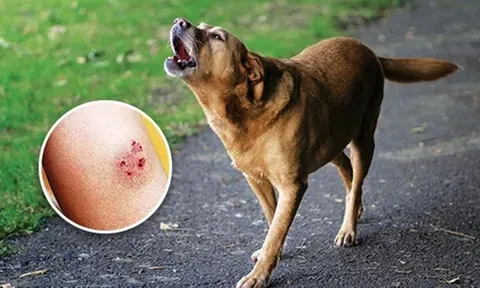 Đang ngồi chơi, hai trẻ bị chó dại lao vào tấn công
