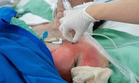 Tình trạng sức khỏe các nạn nhân vụ cháy nhà khiến 2 người tử vong
