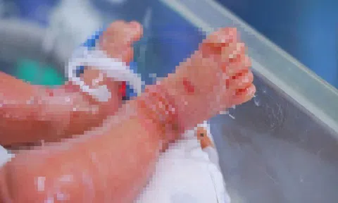 Bé trai sinh non mắc bệnh vảy cá hiếm gặp