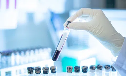 Xét nghiệm máu phát hiện sớm đa ung thư của công ty Grail trên lộ trình xin được FDA cấp phép