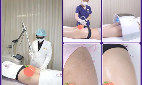 LG Clinic – Phòng khám trị thâm mông hàng đầu TP.HCM với công nghệ hiện đại & không gian riêng tư