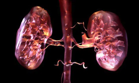 Các thực phẩm khiến bạn nhanh suy thận