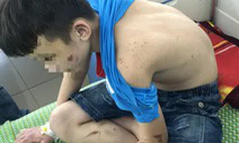 Vụ bé trai bị bạo hành: Hàng xóm có nghi ngờ nhưng không ai để ý